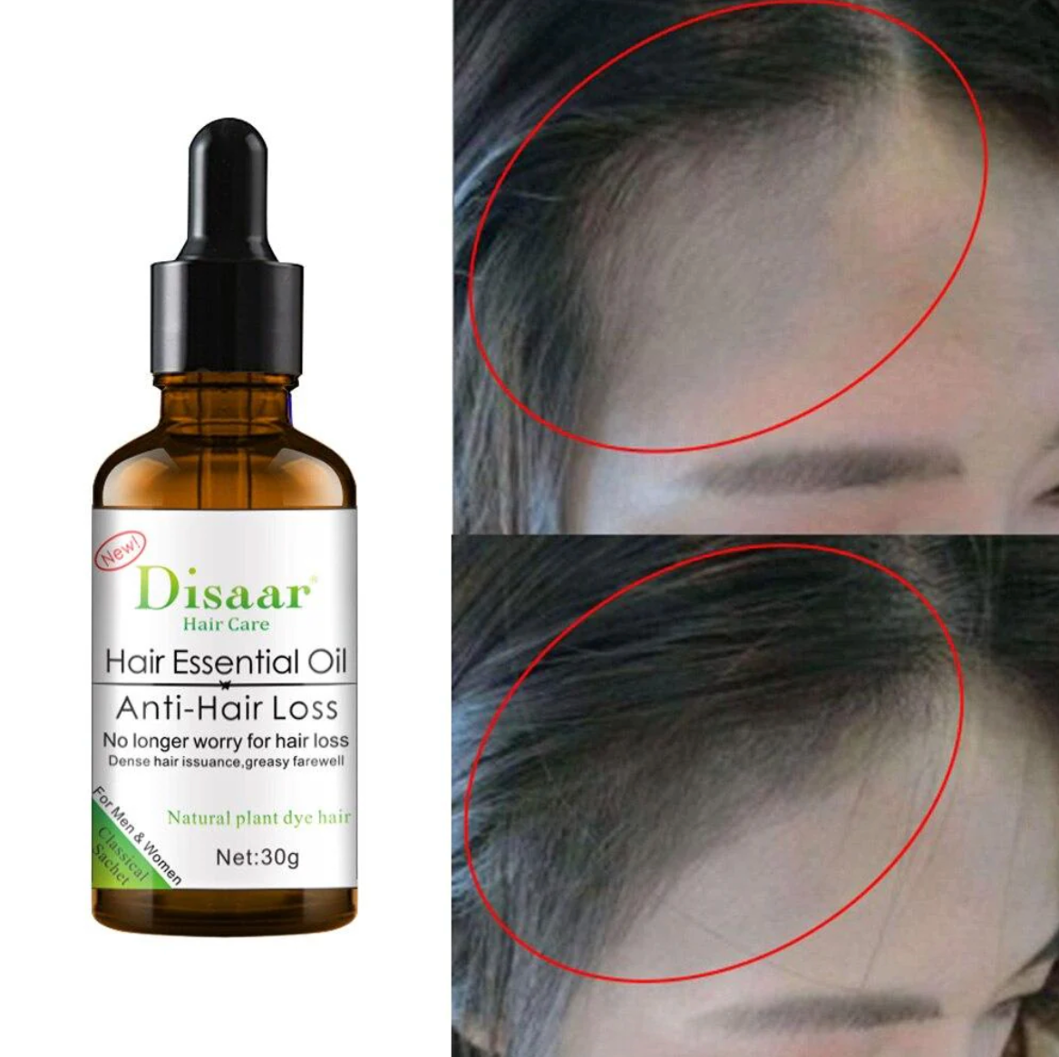 Aceite Profesional Capilar
