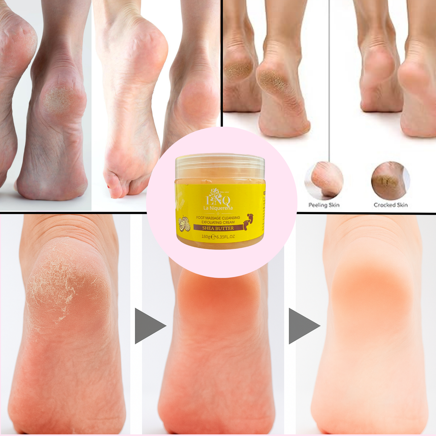 Gel Exfoliante para Pies